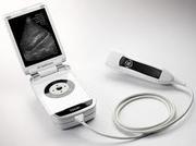 GE Vscan Ultrasound Scanner
